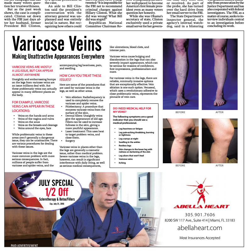 Varicose vein article