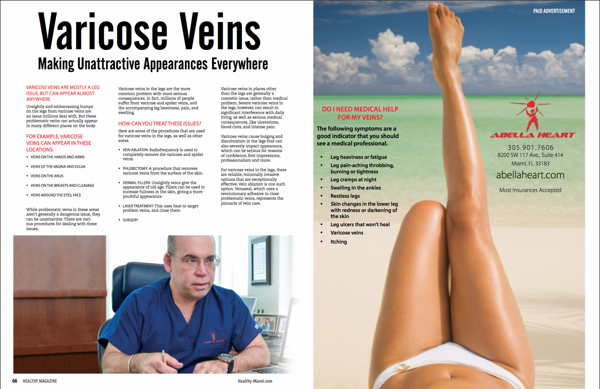 Varicose vein article