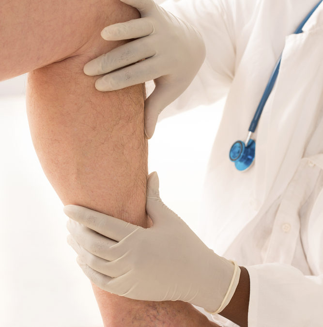 Treatments for Venous Insufficiency