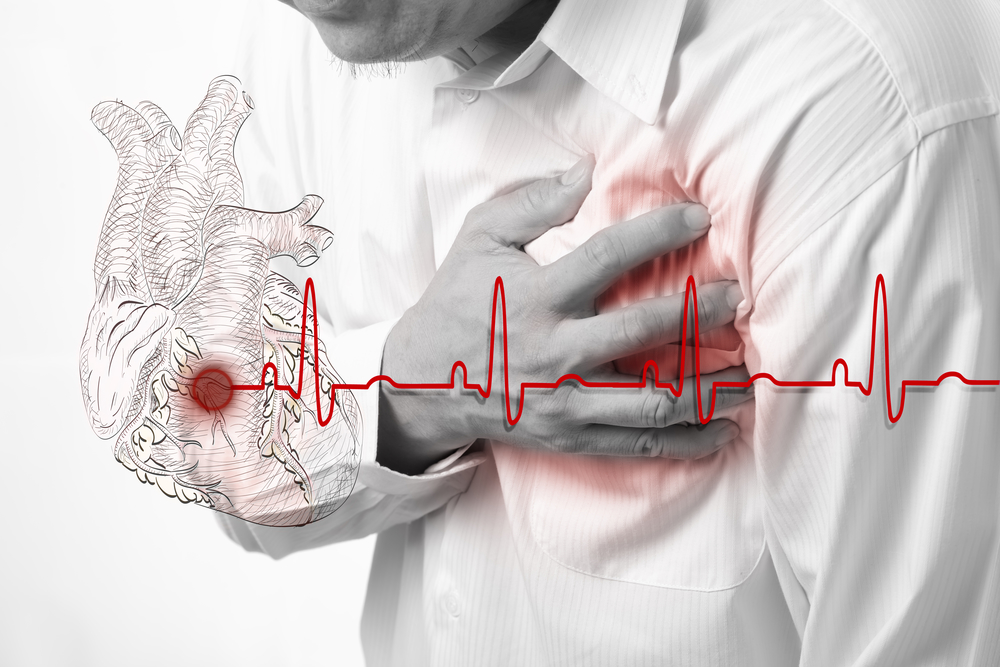 Do You Know All the Triggers of a Heart Attack?