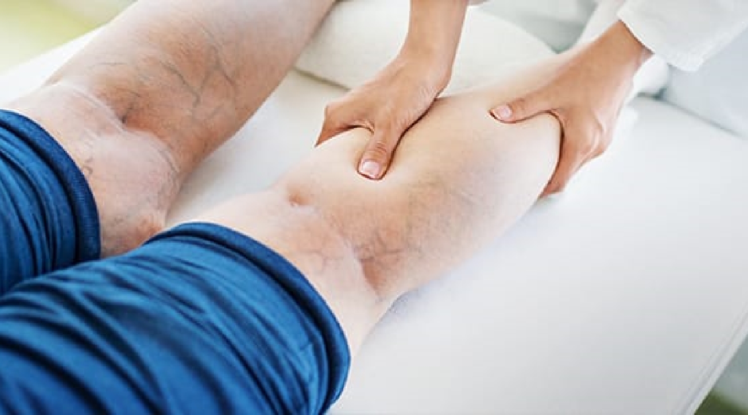 Venous Insufficiency being checked by doctor